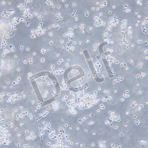 OCI-LY3人彌漫大B細胞淋巴瘤細胞