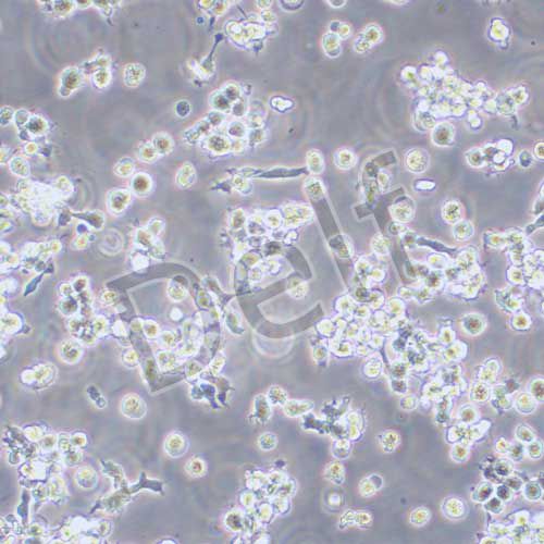 OCI-LY3人彌漫大B細胞淋巴瘤細胞