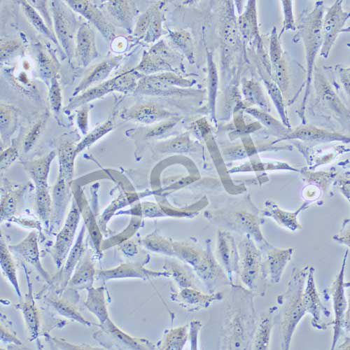 Ocut-2C 人甲狀腺癌細(xì)胞(未分化)