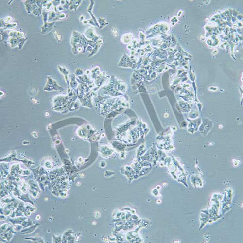 OE-19人食管癌細胞