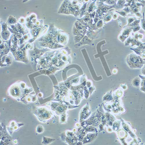 OE-19人食管癌細胞