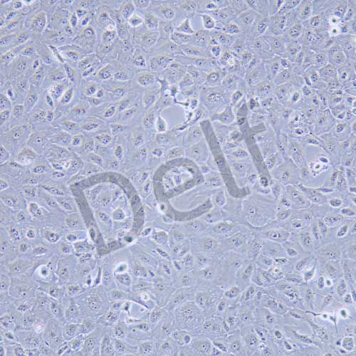 OS-RC-2 人腎癌細(xì)胞