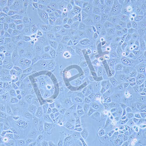 OVCAR-3 人卵巢腺癌細(xì)胞