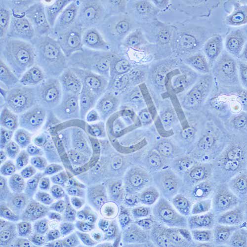 OVCAR-3 人卵巢腺癌細(xì)胞