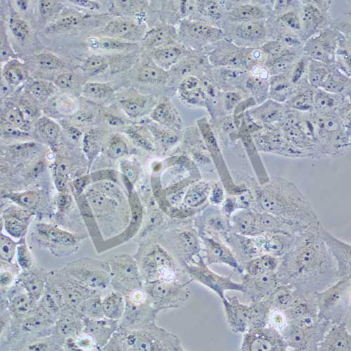 OVCAR-8 人卵巢癌腺癌細(xì)胞