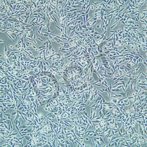 P53R 人結(jié)直腸癌細(xì)胞