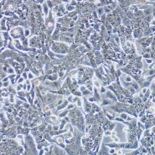 PC-12低分化 大鼠腎上腺嗜鉻細(xì)胞瘤細(xì)胞 低分化