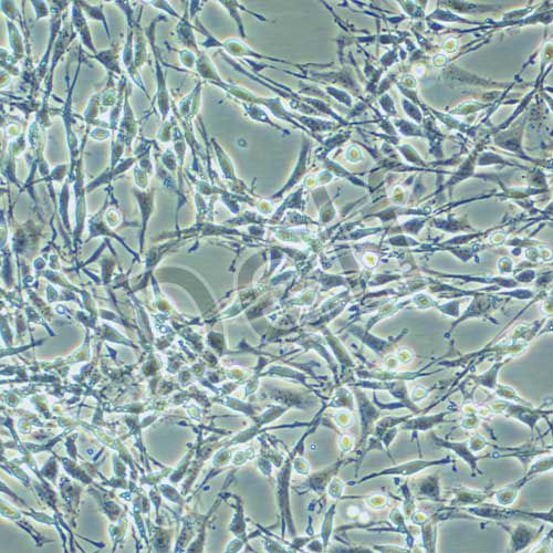 PC-12高分化 大鼠腎上腺嗜鉻細(xì)胞瘤細(xì)胞 高分化