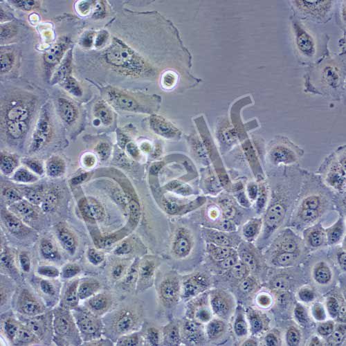 PL45 人胰腺導(dǎo)管腺癌細(xì)胞