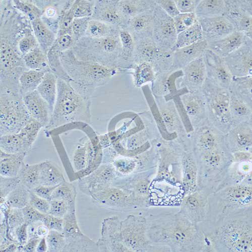 PLC-PRF-5 人肝癌亞力山大細胞