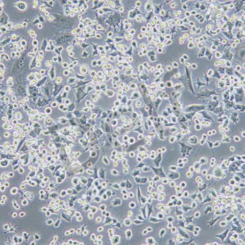 RAG 小鼠腎腺癌細(xì)胞