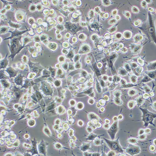 RAG 小鼠腎腺癌細(xì)胞