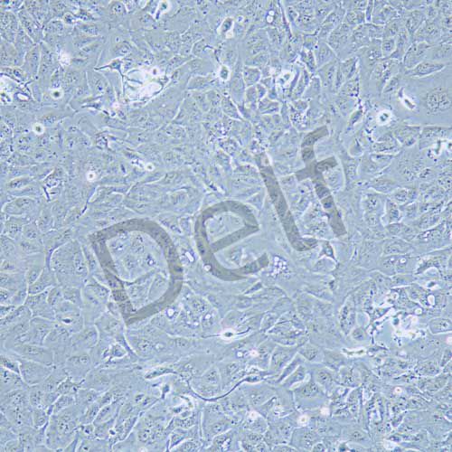 RBE 人肝膽管癌細胞