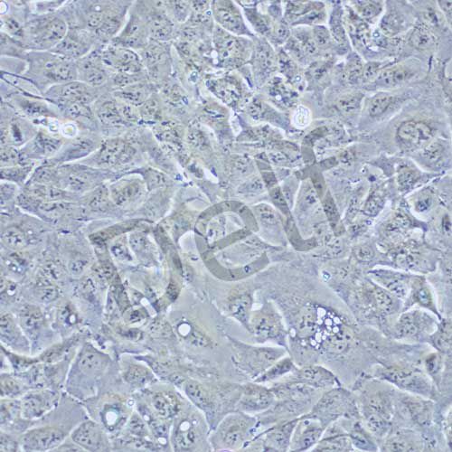 RBE 人肝膽管癌細胞