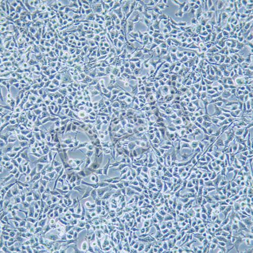 RD 人橫紋肌肉瘤細胞