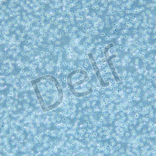 REH 人急性非B非T淋巴細胞白血病細胞