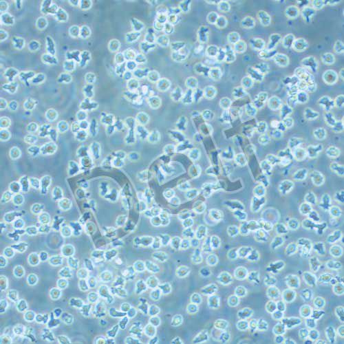 REH 人急性非B非T淋巴細胞白血病細胞