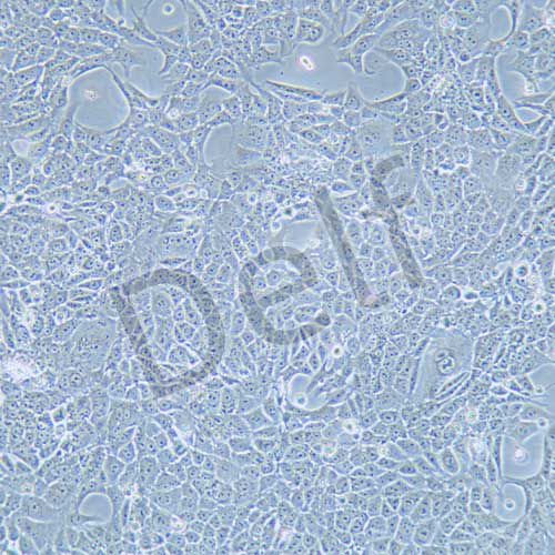 RENCA 小鼠腎癌細(xì)胞