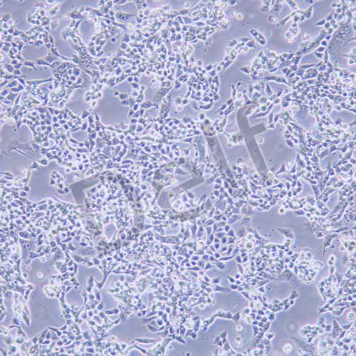 RL95-2 人子宮內(nèi)膜癌細(xì)胞