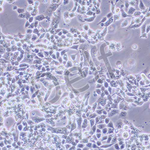 RL95-2 人子宮內(nèi)膜癌細(xì)胞