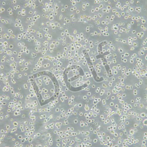 RPMI8226 人多發(fā)性骨髓瘤外周血B淋巴細(xì)胞