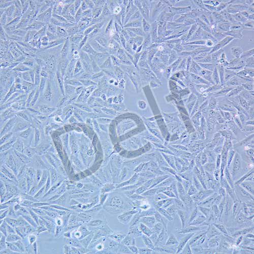 Saos-2 人成骨肉瘤細(xì)胞