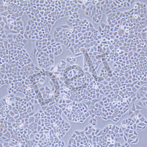 SBC-2 人小細(xì)胞肺癌細(xì)胞