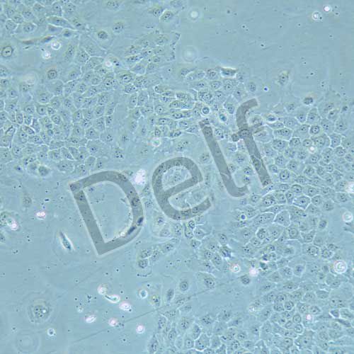 SCaBER 人膀胱鱗癌細胞