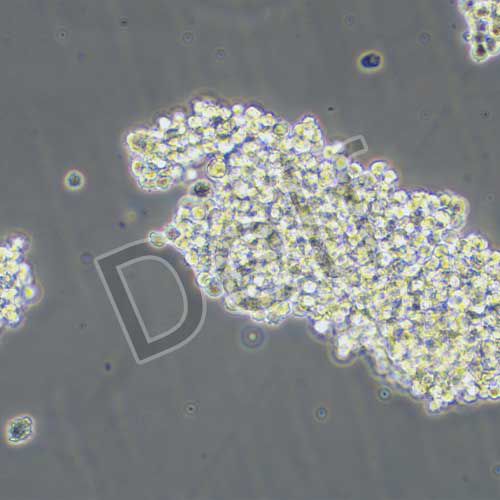 SHP-77 人小細(xì)胞肺癌細(xì)胞