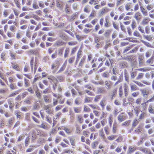 SiHa 人子宮頸鱗癌細(xì)胞