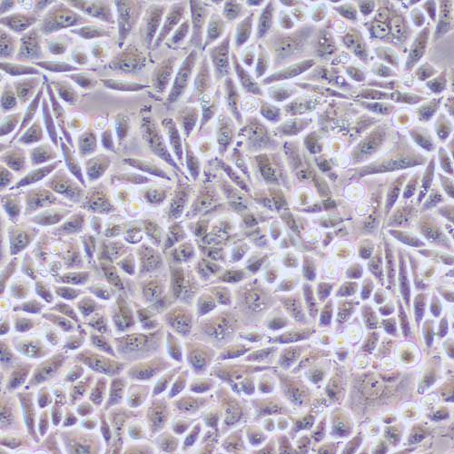 SiHa 人子宮頸鱗癌細(xì)胞