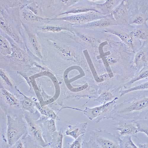 SJSA-1 人骨肉瘤細(xì)胞