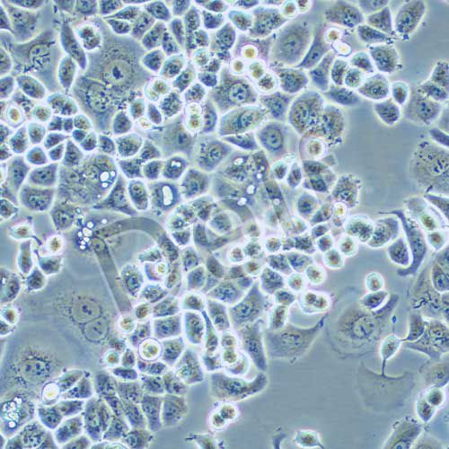 SK-BR-3 人乳腺腺癌細(xì)胞