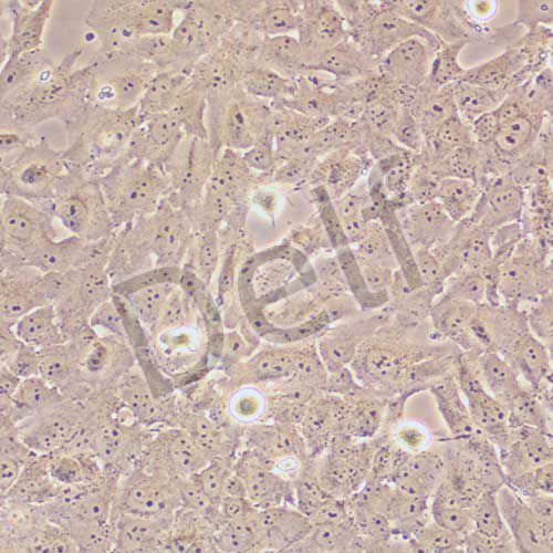 SK-MES-1 人肺鱗癌細(xì)胞