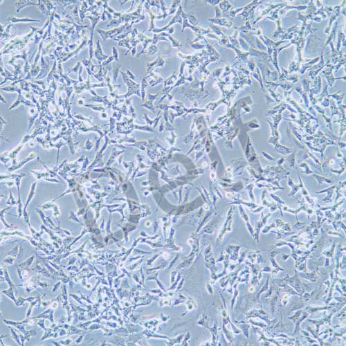 SK-N-BE(2) 人神經(jīng)母細(xì)胞瘤細(xì)胞