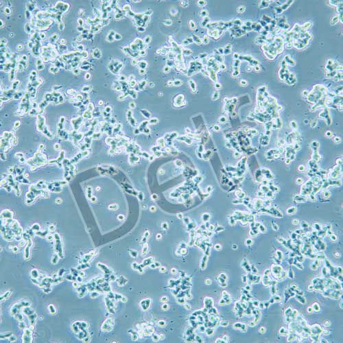 SK-NEP-1 人腎母細(xì)胞瘤細(xì)胞