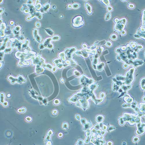 SK-NEP-1 人腎母細(xì)胞瘤細(xì)胞