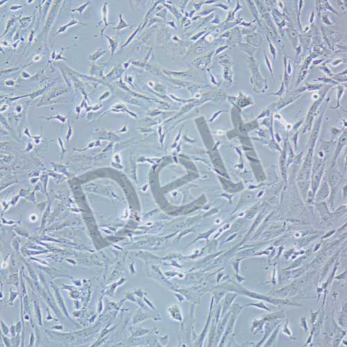 SK-N-SH 人神經(jīng)母細胞瘤細胞