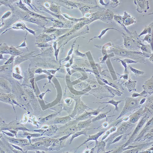SK-N-SH 人神經(jīng)母細胞瘤細胞