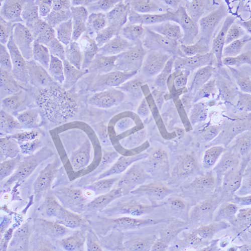SK-OV-3 人卵巢癌細(xì)胞
