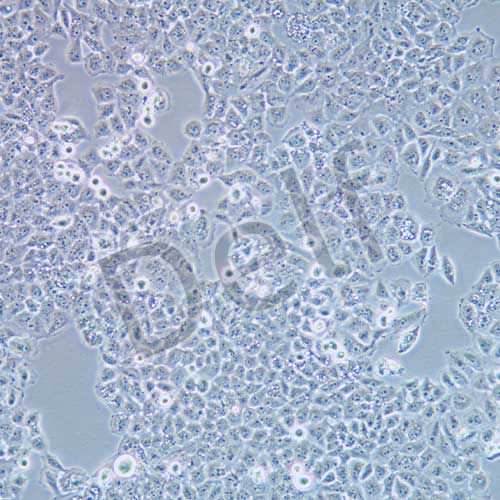 SMMC-7721 人肝癌細(xì)胞