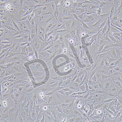 SNB-19 人膠質瘤細胞