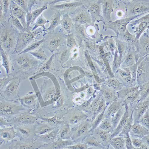 SNB-19 人膠質瘤細胞