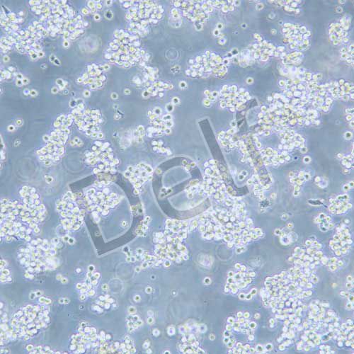 SNU-1 人胃癌細(xì)胞