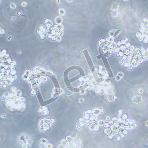 SNU-1 人胃癌細(xì)胞