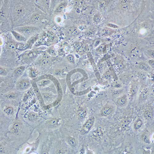 SNU-182 人肝癌細(xì)胞