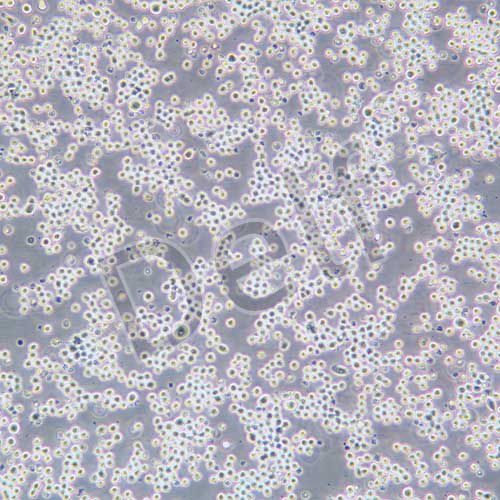 Sp2/O 小鼠骨髓瘤細(xì)胞