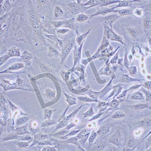 SVEC4-10 小鼠淋巴結(jié)內(nèi)皮細(xì)胞