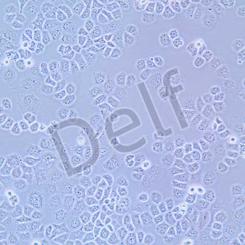 SW-13 人腎上腺皮質(zhì)癌細胞