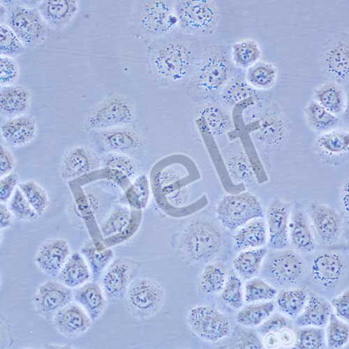 SW-13 人腎上腺皮質(zhì)癌細胞